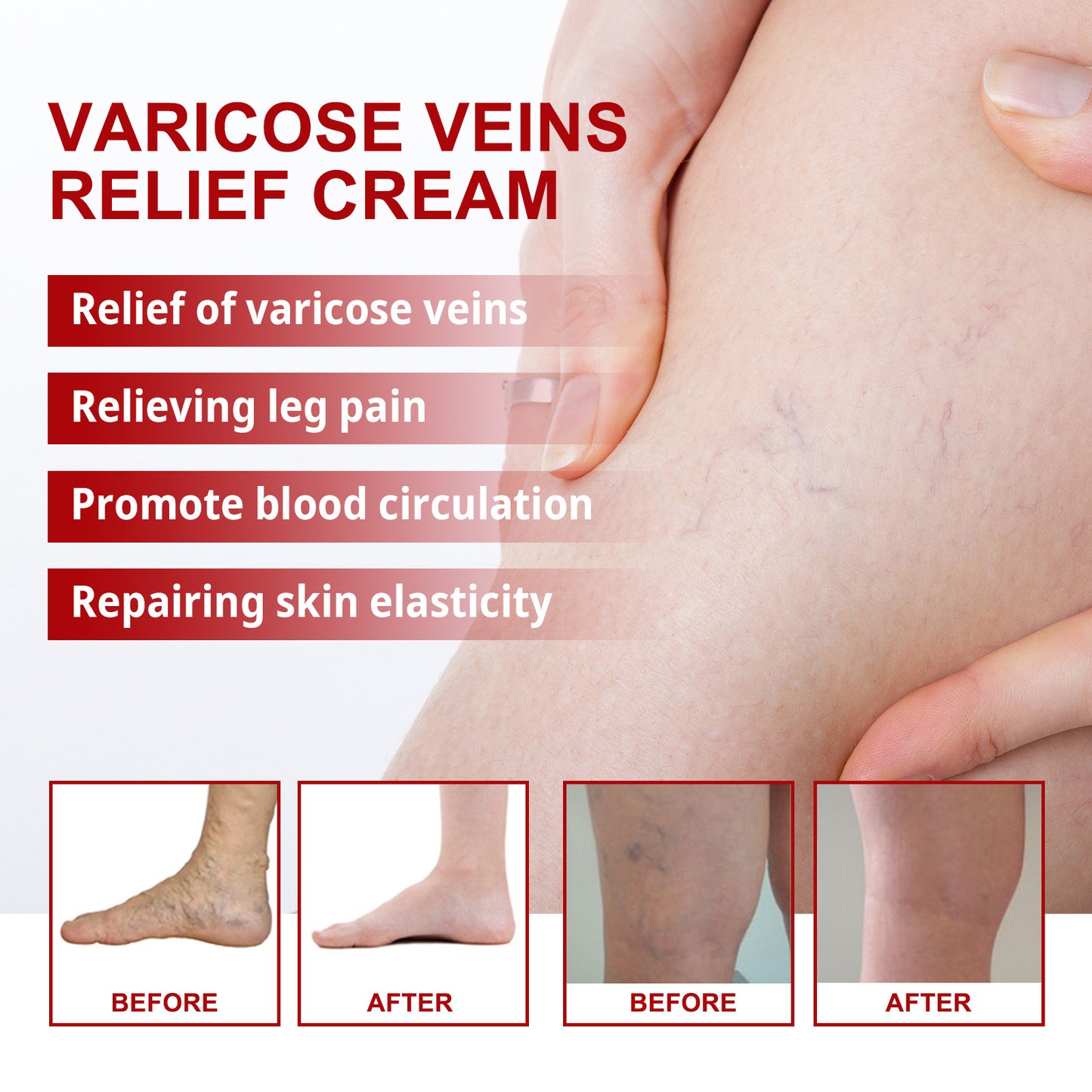 Seurico™ Varicose Veins Cream