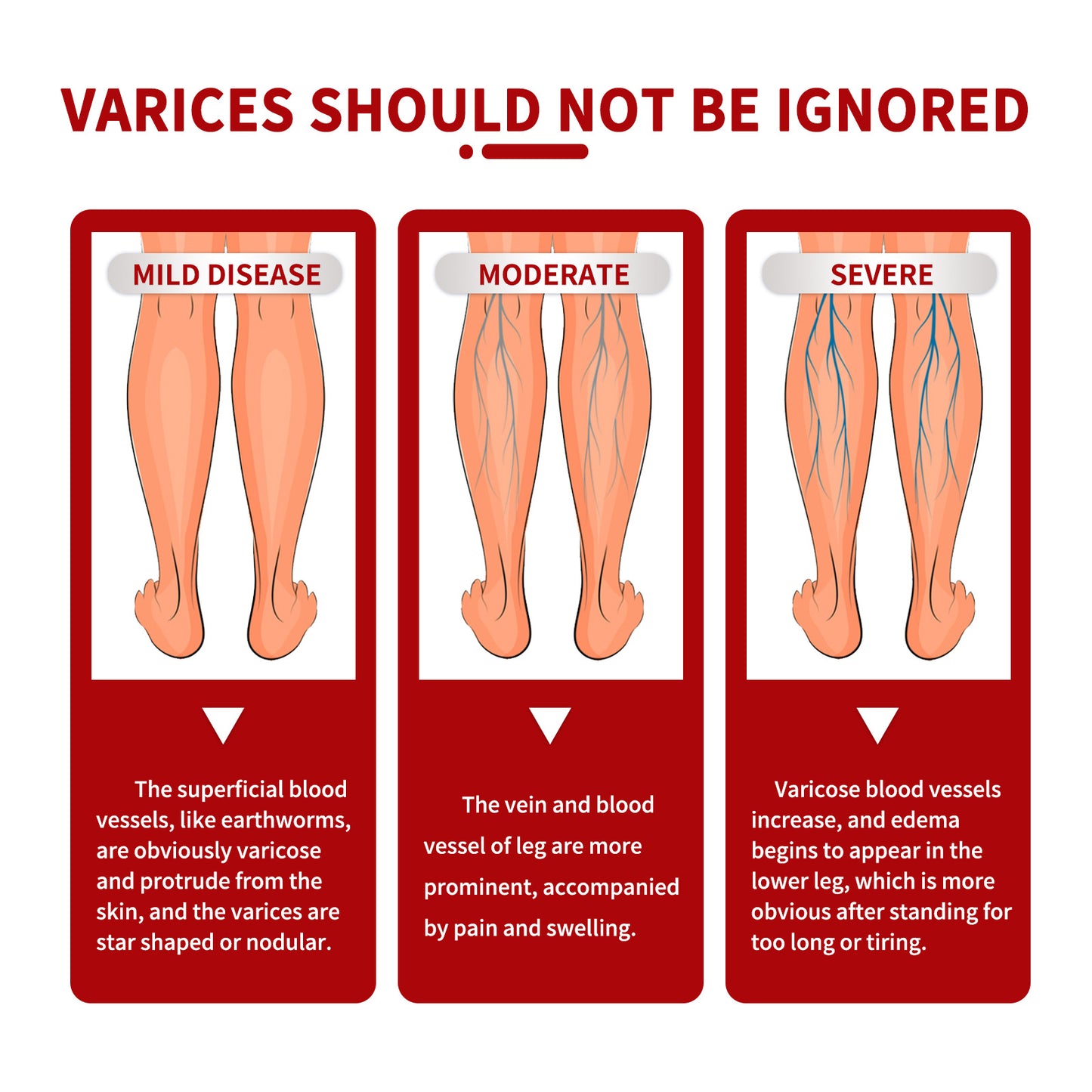 Seurico™ Varicose Veins Cream