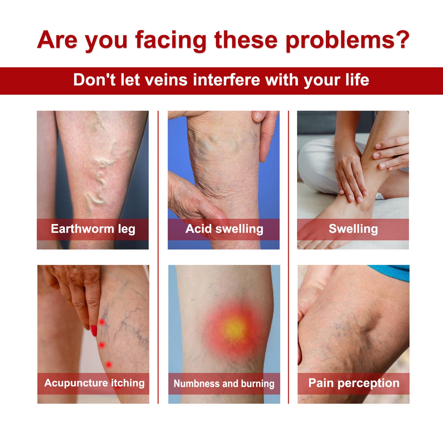 Seurico™ Varicose Veins Cream