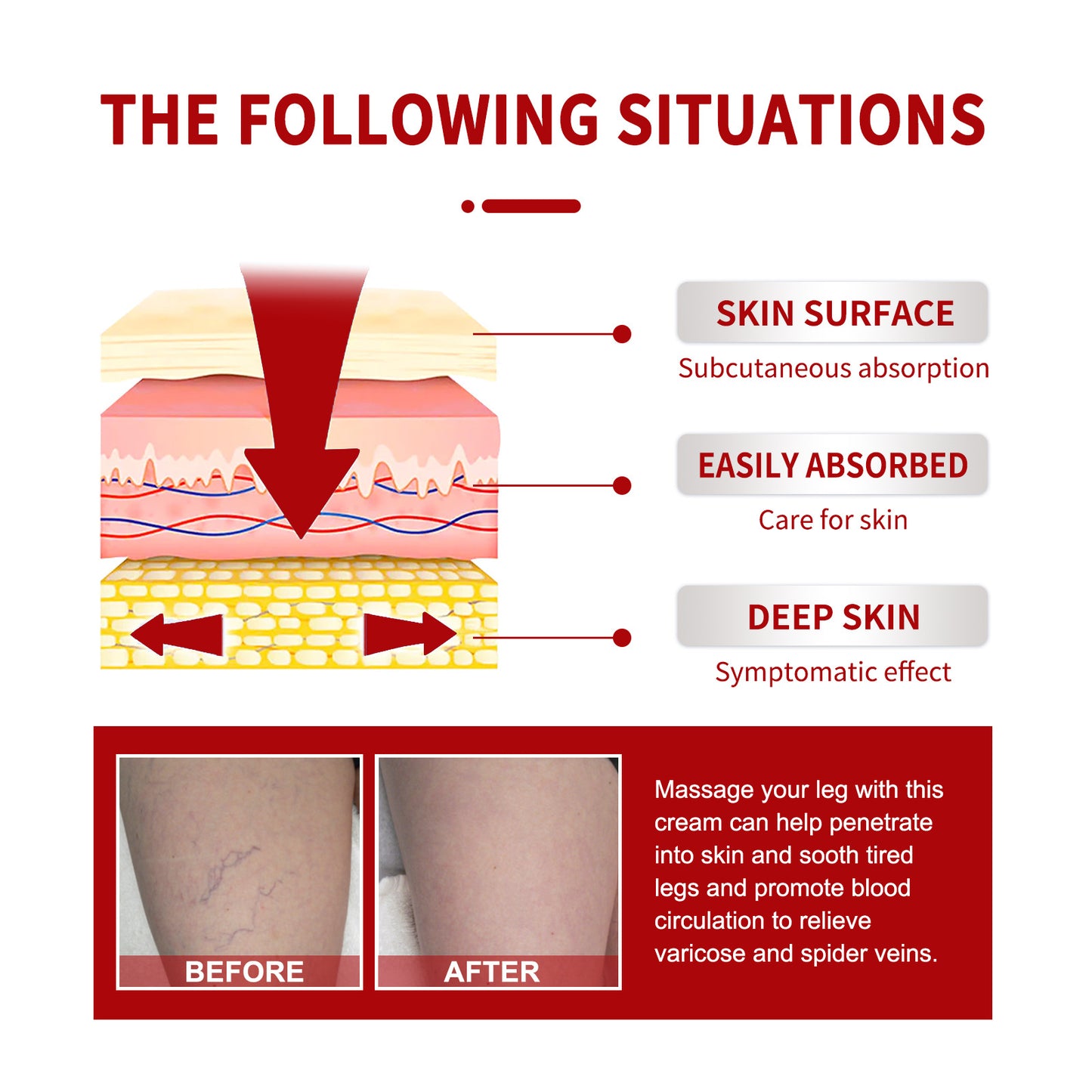 Seurico™ Varicose Veins Cream