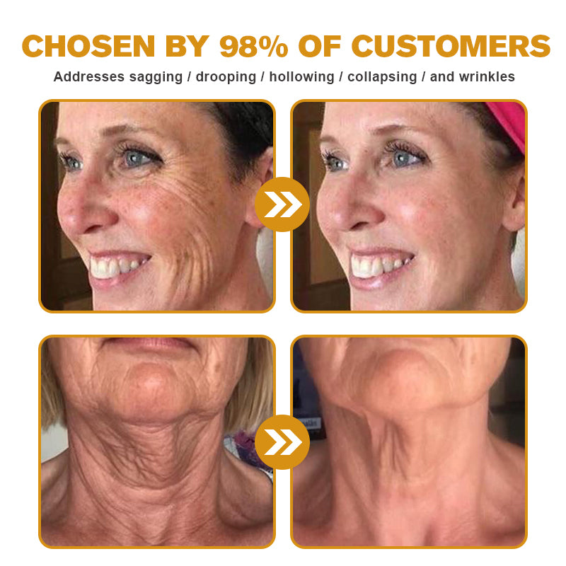 (Made and Shipped from USA) 🧑⚕️ODALIT™ Botox Bee Venom Wrinkle Removal Cream- LAST DAY 70% OFF🔥