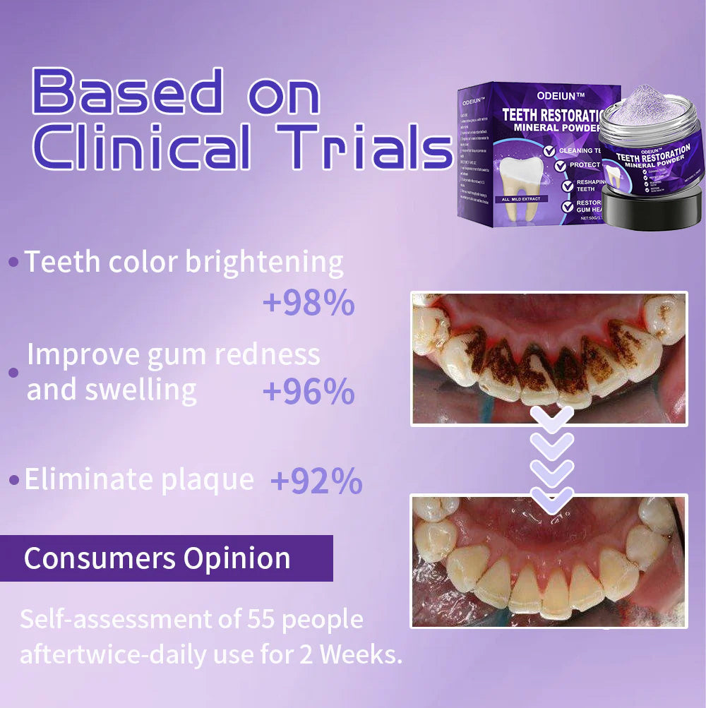 Flash Sale😍 - Don’t Miss Out - ODEIUN™ Teeth Restoration Mineral Powder🦷(ADA recommended)👩‍⚕️