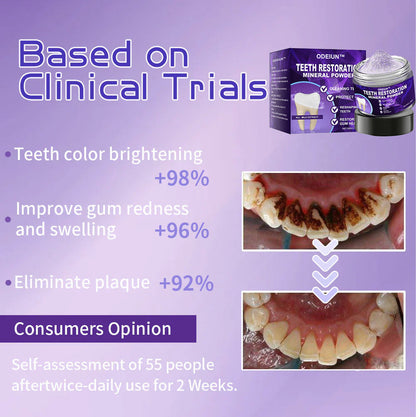 Flash Sale😍 - Don’t Miss Out - ODEIUN™ Teeth Restoration Mineral Powder🦷(ADA recommended)👩‍⚕️