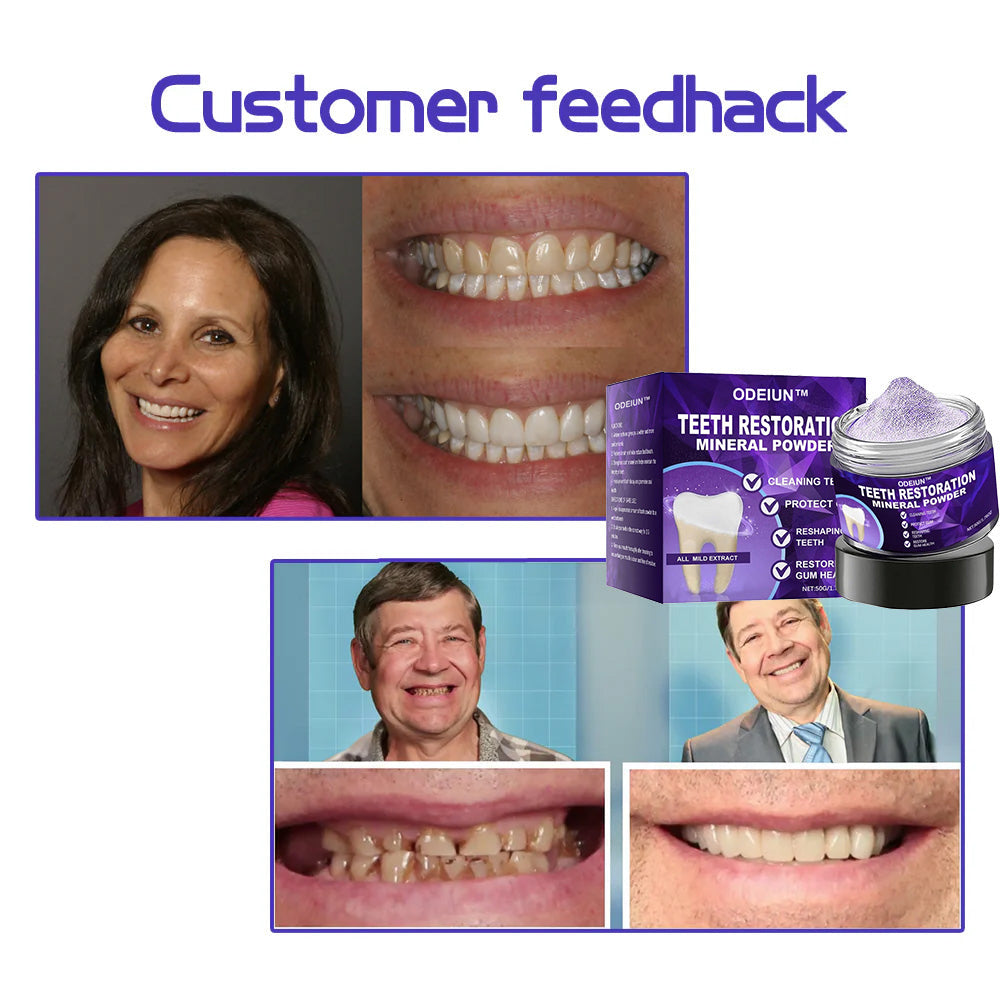 Flash Sale😍 - Don’t Miss Out - ODEIUN™ Teeth Restoration Mineral Powder🦷(ADA recommended)👩‍⚕️