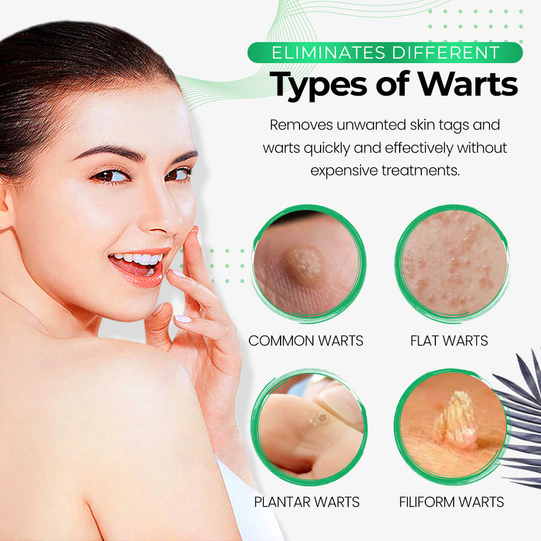 SmoothSkin™ Wart Eliminator Soap