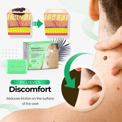 SmoothSkin™ Wart Eliminator Soap