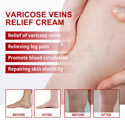 Seurico™ Varicose Veins Cream