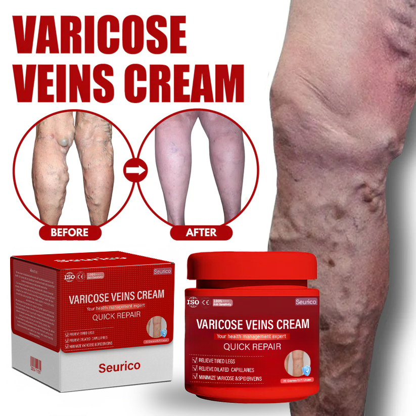 Seurico™ Varicose Veins Cream