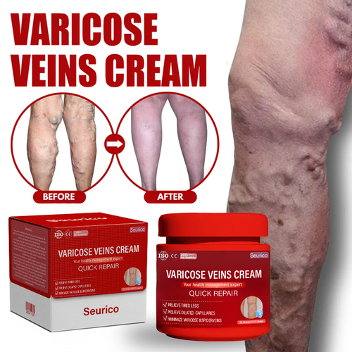 Seurico™ Varicose Veins Cream
