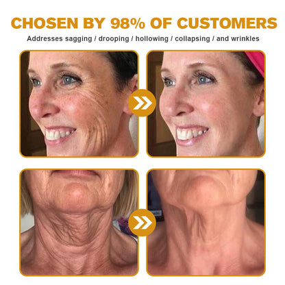 (Made and Shipped from USA) 🧑‍⚕️ODALIT™ Botox Bee Venom Wrinkle Removal Cream- LAST DAY 70% OFF🔥