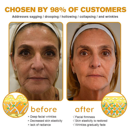 (Made and Shipped from USA) 🧑‍⚕️ODALIT™ Botox Bee Venom Wrinkle Removal Cream- LAST DAY 70% OFF🔥